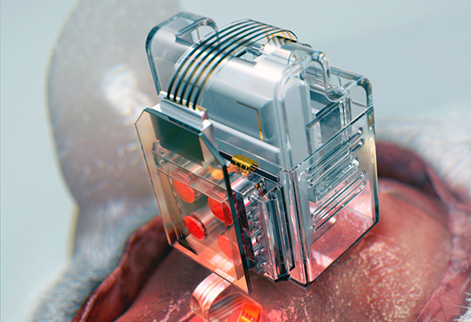 스마트폰으로 뇌세포 조작하는 소프트 신경이식장치 개발